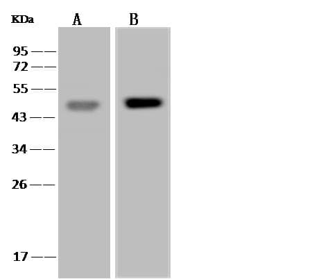 GLA / Alpha Galactosidase Antibody (clone 08, Preservative Free)