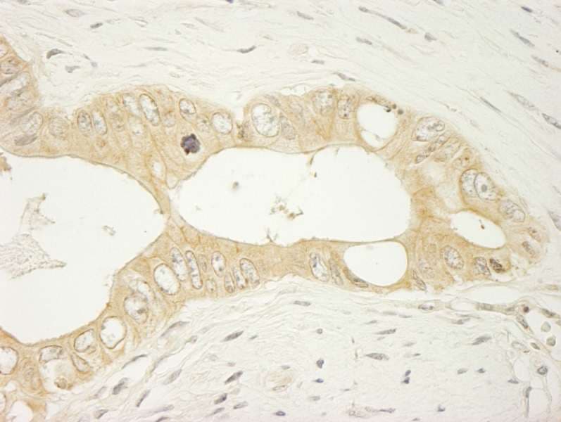 LARP1 / La-Related Protein 1 Antibody (aa575-625)