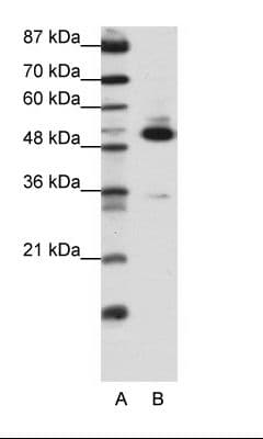 TADA3 / ADA3 Antibody (C-Terminus)