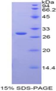 Rat CST / GAL3ST1 Protein (Recombinant His-T7)