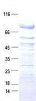 Human TMPRSS6 Protein (Recombinant DDK,C-terminus)
