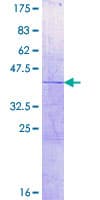Human HIST1H2AC Protein (Recombinant GST)