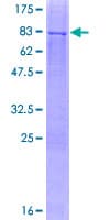 Human HEXDC Protein (Recombinant GST)