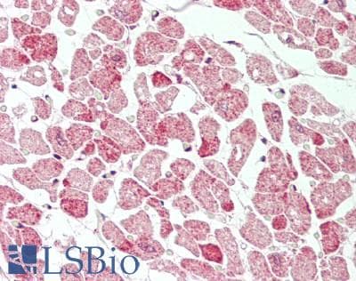 PathPlus™ Polyclonal Rabbit anti-Human BECN1 / Beclin-1 Antibody (N-Terminus, IHC, WB)