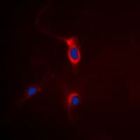 Polyclonal Rabbit anti-Human GRM4 / MGLUR4 Antibody (C-Terminus, IHC, IF, WB)