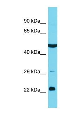 KBTBD12 Antibody (aa487-536)