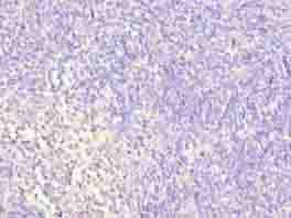 Polyclonal Rabbit anti-Human WDR74 Antibody (IHC, WB)