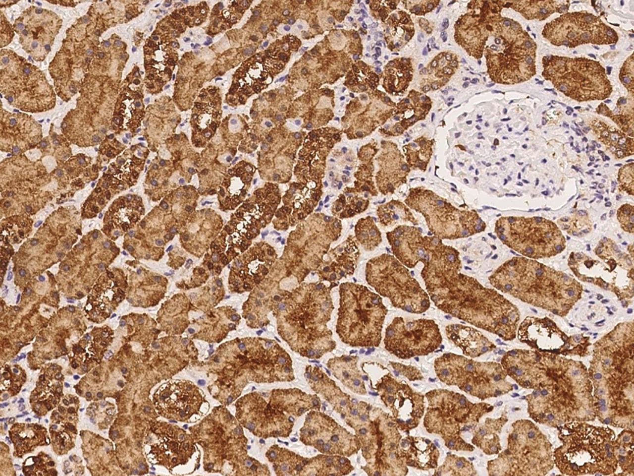 TSG / TWSG1 Antibody