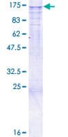 Human CHERP Protein (Recombinant GST)