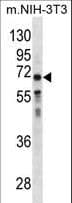 GGT1 / GGT Antibody (aa124-152)