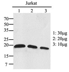 IHC-plus™ RAC2 Antibody (clone AT2G11)
