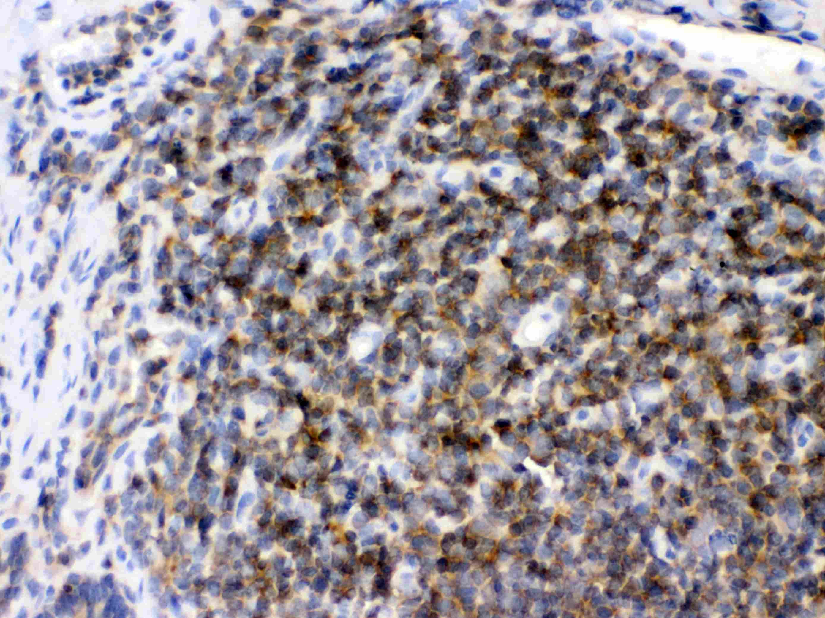 ARHGEF1 Antibody