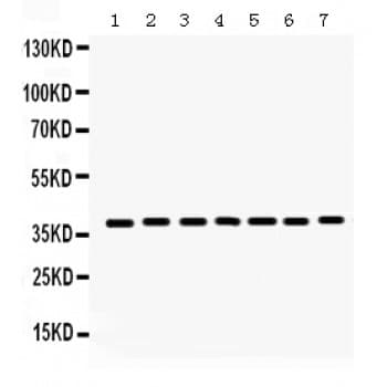 HDAC11 Antibody (aa47-81)