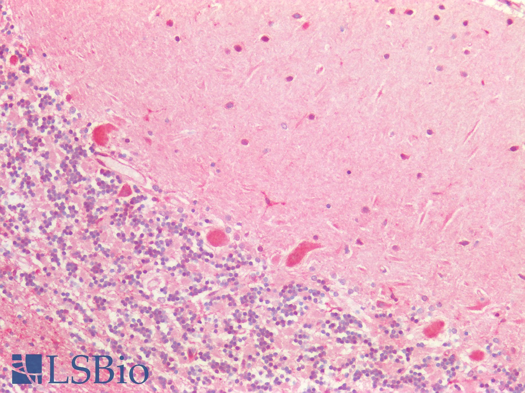 PathPlus™ Polyclonal Rabbit anti-Human BECN1 / Beclin-1 Antibody (N-Terminus, IHC, WB)