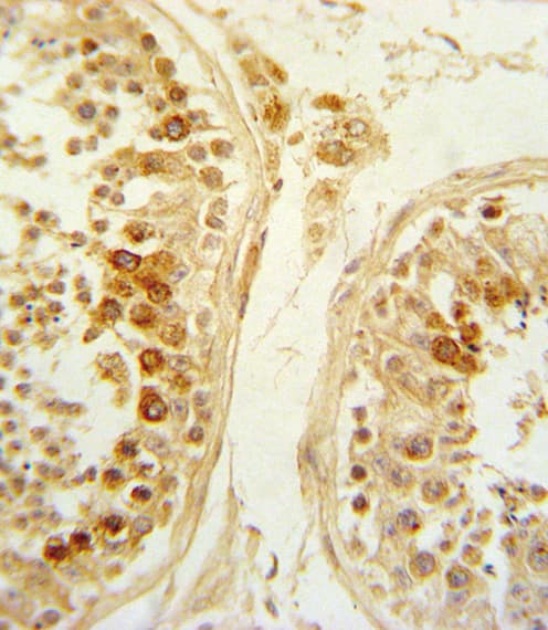 SFRP1 Antibody (aa26-55)