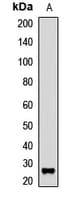 Polyclonal Rabbit anti-Human ALY / THOC4 Antibody (WB)