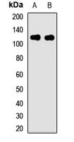 PIBF1 / PIBF Antibody