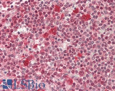TRAPPC12 / TTC15 Antibody (aa579-608, PE)