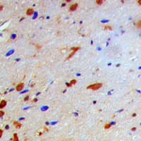 Polyclonal Rabbit anti-Human NFKBIB / IKB Beta / IKBB Antibody (phospho-Thr19, IHC, WB)