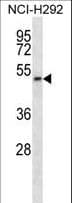 Polyclonal Rabbit anti-Human PIGT Antibody (aa392-421, WB)