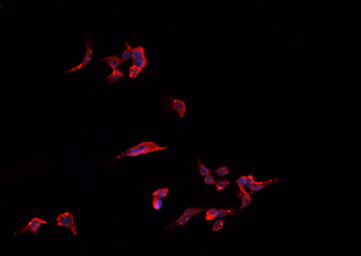 TNFSF13 / APRIL Antibody