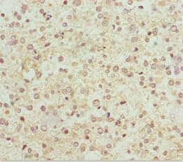 NDUFS1 Antibody