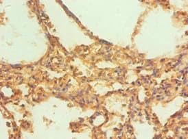 Polyclonal Rabbit anti-Human CAPN1 / Calpain 1 Antibody (aa20-330, IHC)
