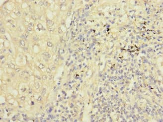 PPIL2 / CYP60 Antibody