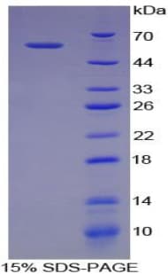 Mouse NPTX1 Protein (Recombinant His-GST)