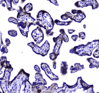 Polyclonal Rabbit anti-Human MAC-2-BP / LGALS3BP Antibody (IHC, WB)