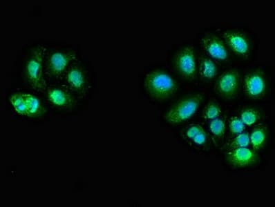 Polyclonal Rabbit anti-Human ZFAND6 Antibody (IHC, IF)