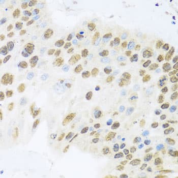 ZBTB17 / MIZ-1 Antibody