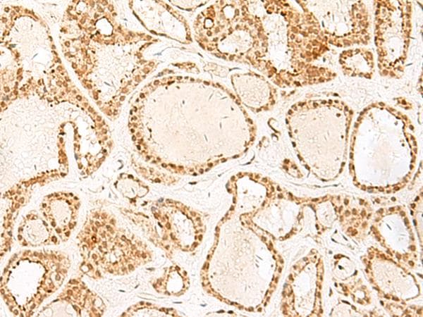 PSPC1 Antibody