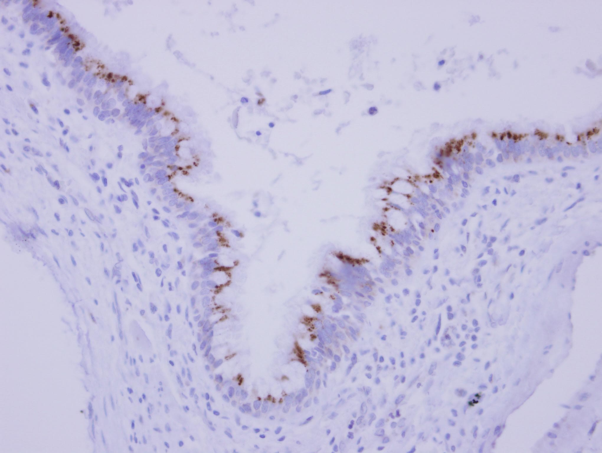 FAM164A / CGI-62 Antibody