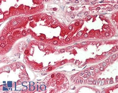 IHC-plus™ SOD1 / Cu-Zn SOD Antibody (clone 8B10)