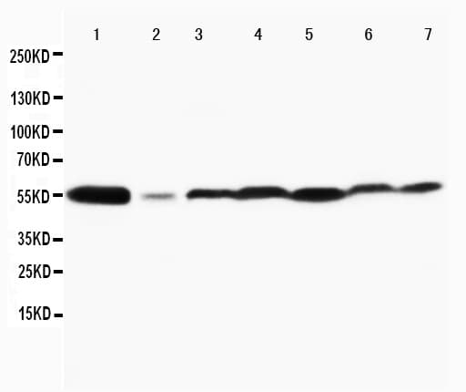 Polyclonal Rabbit anti-Human MAPK8 / JNK1 Antibody (aa344-363, IHC, WB)