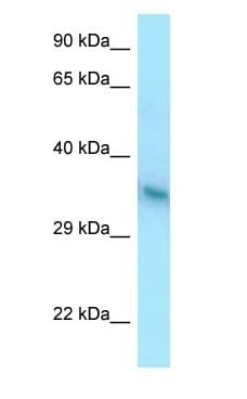 Polyclonal Rabbit anti-Human YIPF1 Antibody (C-Terminus, WB)