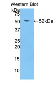 Adiponectin Antibody (aa17-243, APC)