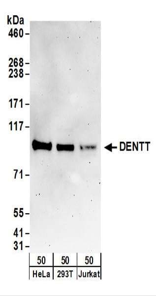 TSPYL2 / DENTT Antibody (aa643-693)