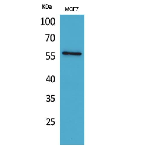 ACVRL1 Antibody (21-70 aa, N-terminal)