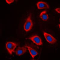 GRM6 / MGLUR6 Antibody (C-Terminus)
