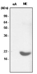 CRYAB / Alpha B Crystallin Antibody (clone 2E8)