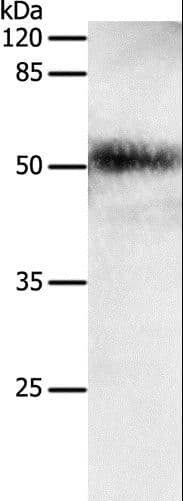 EDA / Ectodysplasin A Antibody