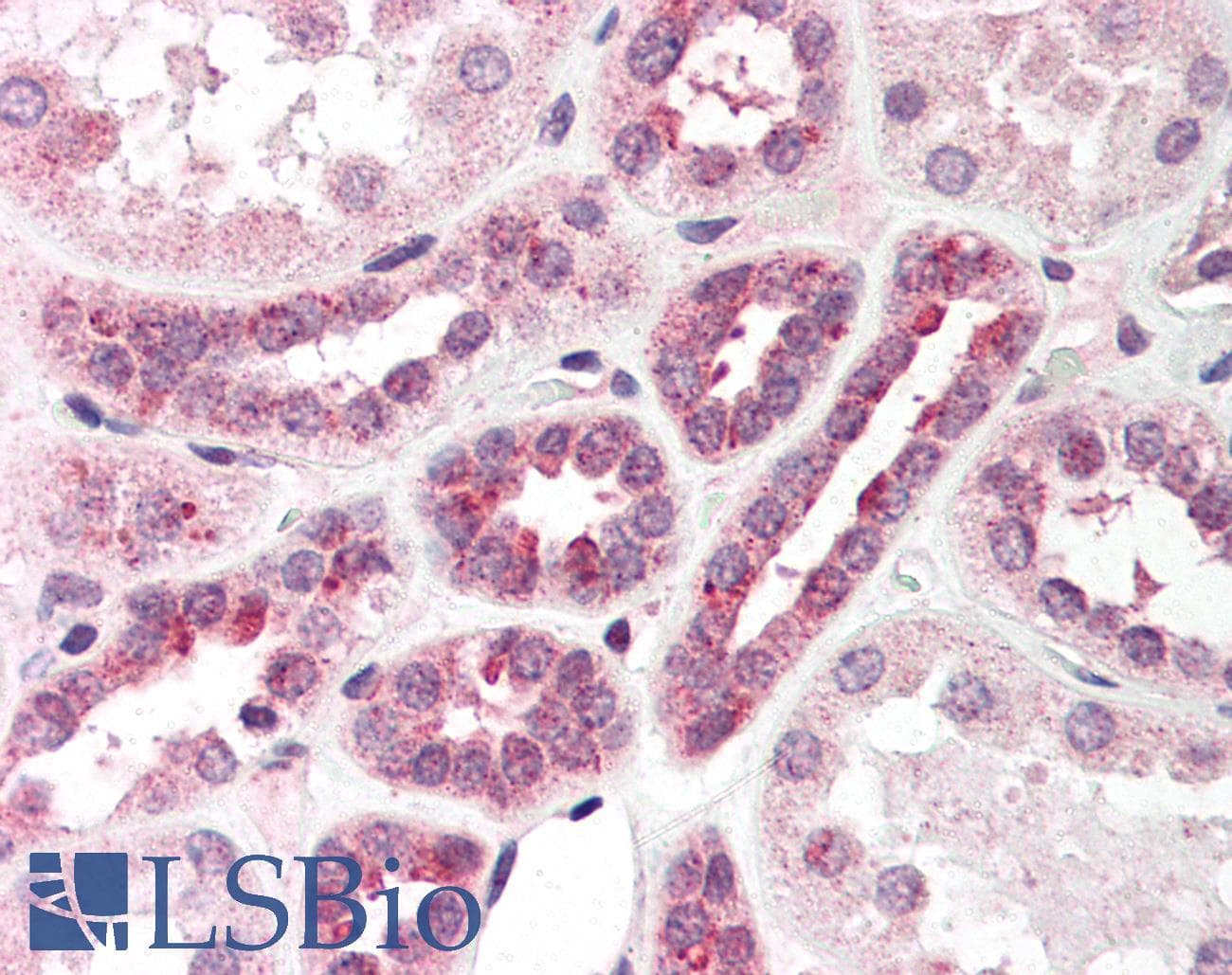 IHC-plus™ PNKP Antibody