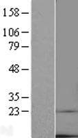 TMEM14C Protein (Over-Expression Lysate Myc-DDK (Flag))