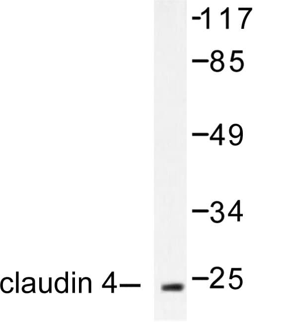 CLDN4 / Claudin 4 Antibody (Pro192)