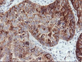 SDCBP / Syntenin Antibody (clone OTI2H6, Carrier-free)