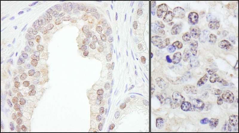 Polyclonal Rabbit anti-Human TRIM33 / TIF1-Gamma Antibody (aa1077-C-term, IHC, WB)
