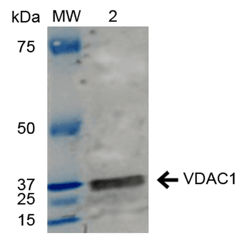 VDAC1 / PORIN Antibody
