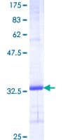 Human SCGB1A1 / Uteroglobin Protein (Recombinant GST)